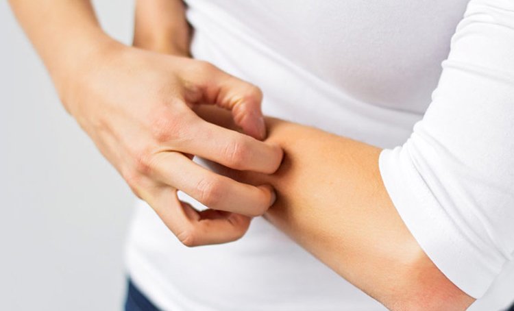 3 tips for treating the worst symptoms of extremely sensitive skin